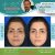 جراحی زیبایی بینی دکتر علی سرابی