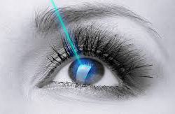 عمل لیزیک و لازک چشم (prk)