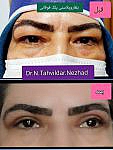 خدمات زیبایی پزشکی دکتر نسرین تحویلدار نژاد