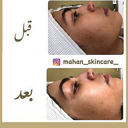 مراقبت پوستی مَهان یک مرکز معتبر در مشهد