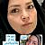 بلفاروپلاستی و جراحی زیبایی پلک مطب دکتر نسرین تحویلدار نژاد
